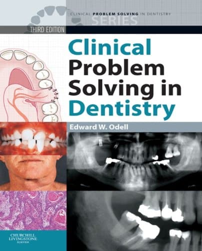 Clinical Problem Solving in Dentistry E-Book (Clinical Problem Solving in Dentistry Series)