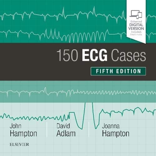 Elsevier 150 ECG Cases