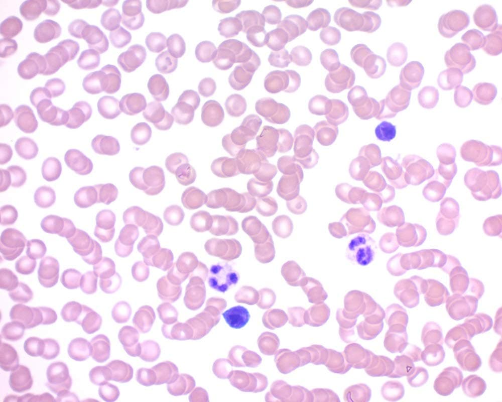 Quick-Dip Differential Stain Pack, 500ml