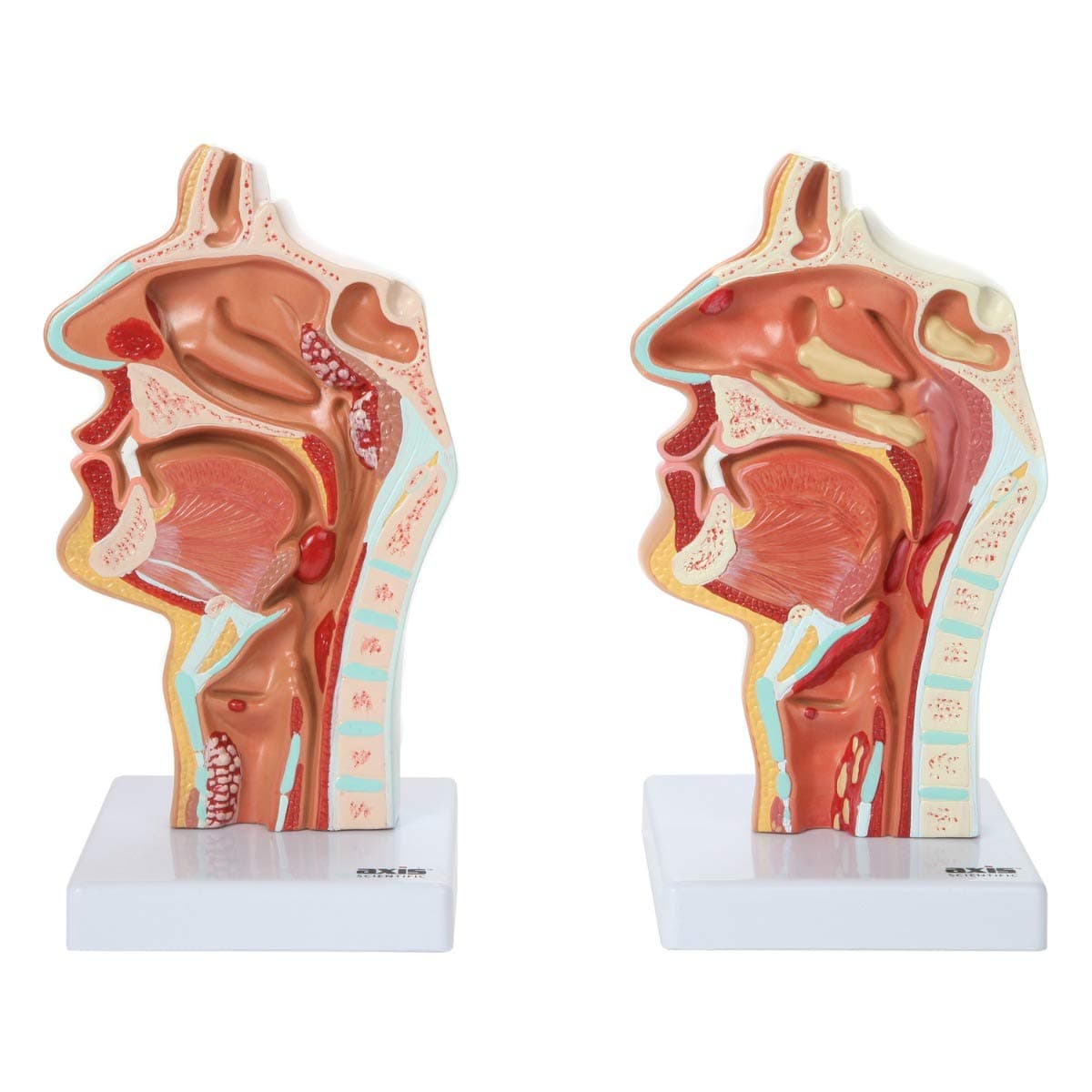 Axis Scientific Larynx and Pharynx Disorders Model