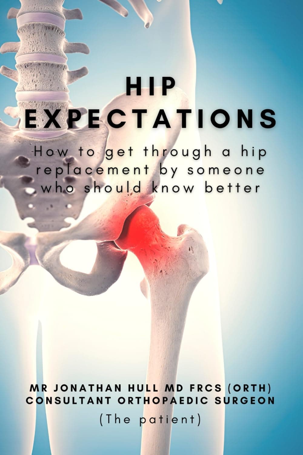 Hip Expectations: How to get through a hip replacement by someone who should know better